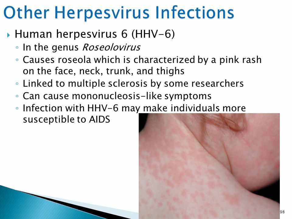 اعراض فيروس الهربس البشري نوع 6 و 7