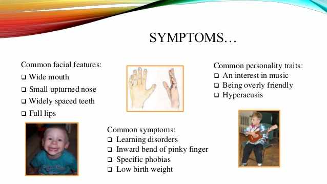 اعراض متلازمة ويليامز