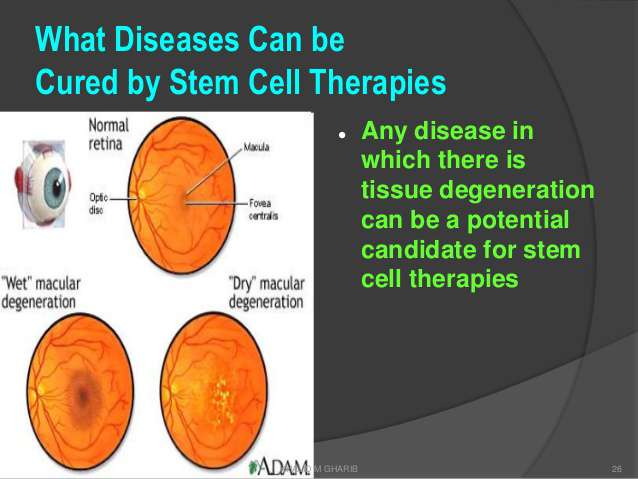 الأمراض التي يمكن علاجها بالخلايا الجذعية