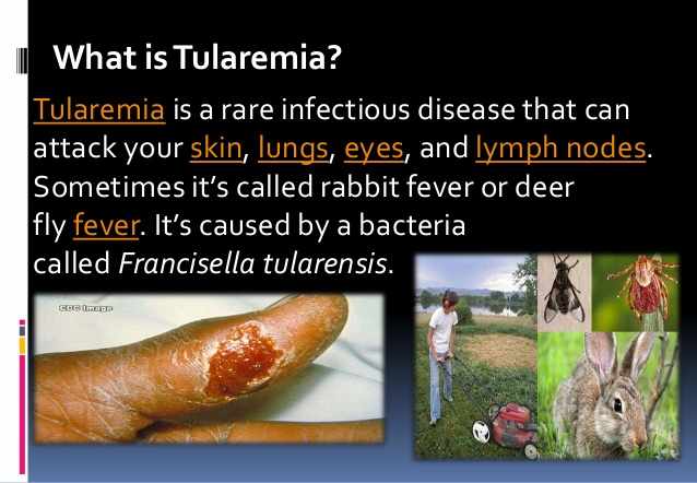 التولاريميا أو حمى الارانب