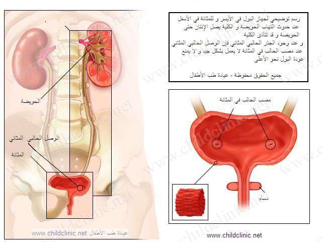 الجهاز البولي الطبيعي