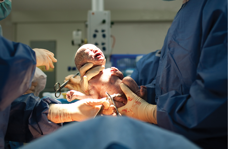 صعوبة تنفس الطفل حديث الولادة