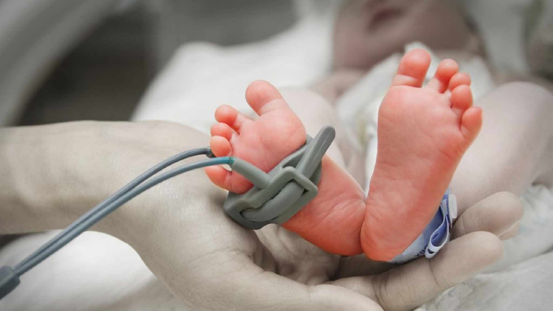 علاج نقص الاوكسحين عند الطفل خلال الولادة