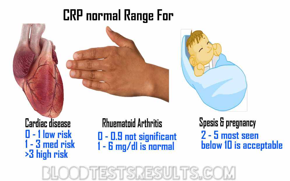 تحليل معامل الالتهاب CRP