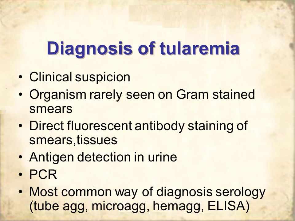 تشخيص التولاريميا أو حمى الارانب