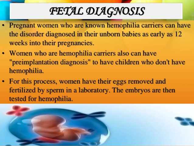 تشخيص الناعور الهيموفيليا عند الجنين قبل الولادة