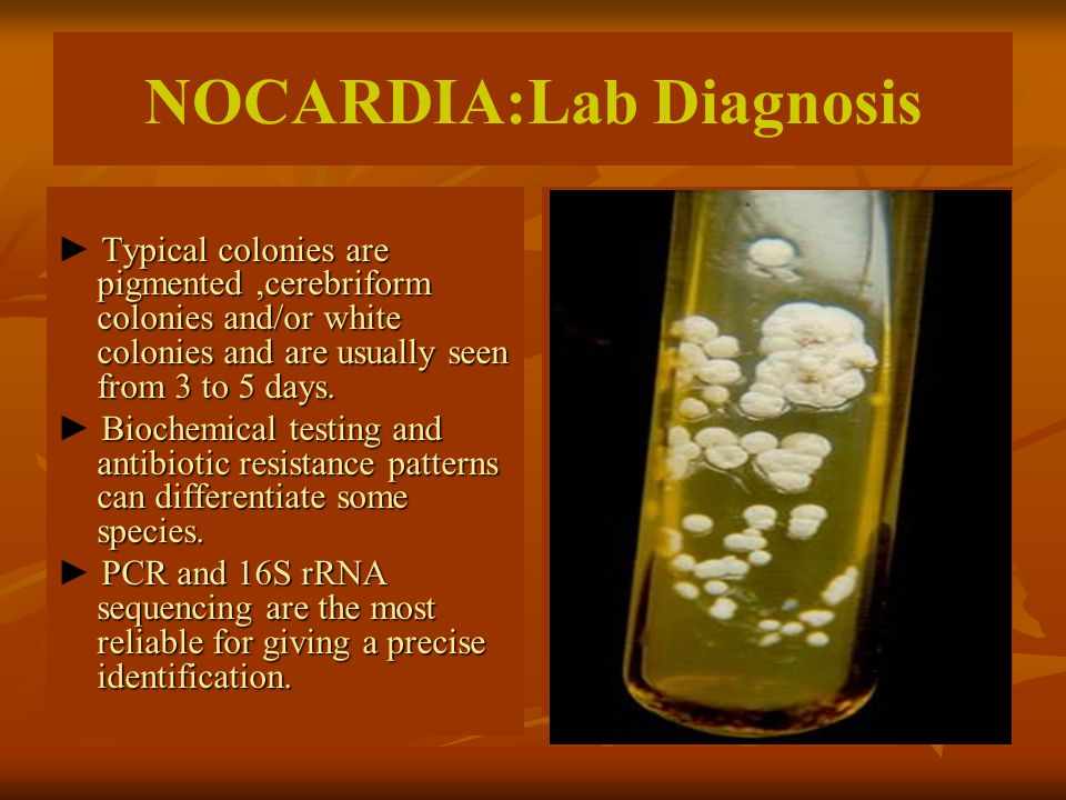 تشخيص بكتيريا النوكارديا
