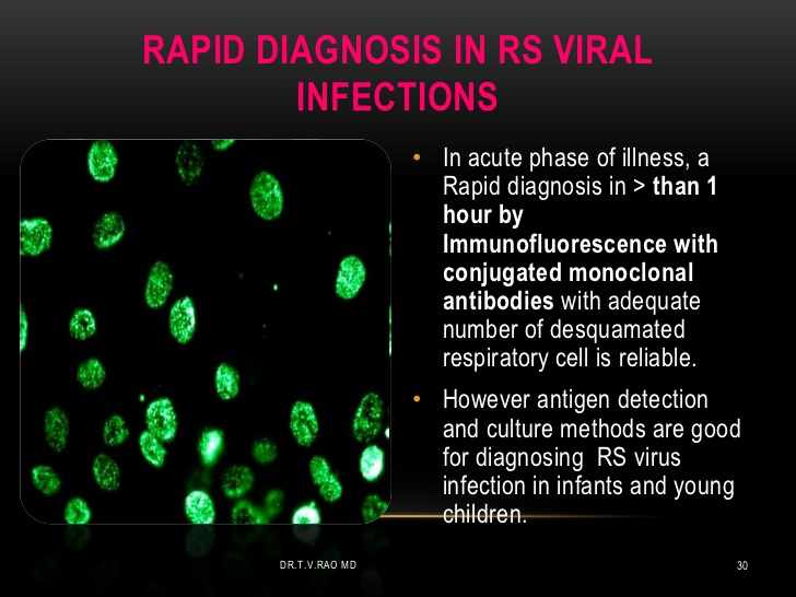 تشخيص فيروس ار اس في RSV