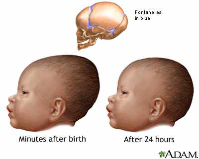 رأس الطفل حديث الولادة