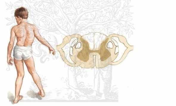 رنح فريدرايخ