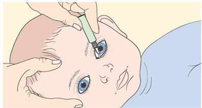 طريقة وضع نقط العين للطفل المولود