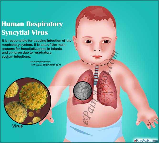 فيروس ار اس في RSV