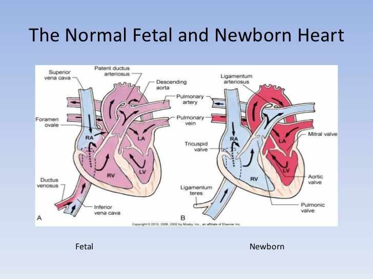 قلب الطفل حديث الولادة