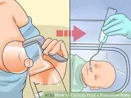 تغذية الطفل الخديج في الحاضنة
