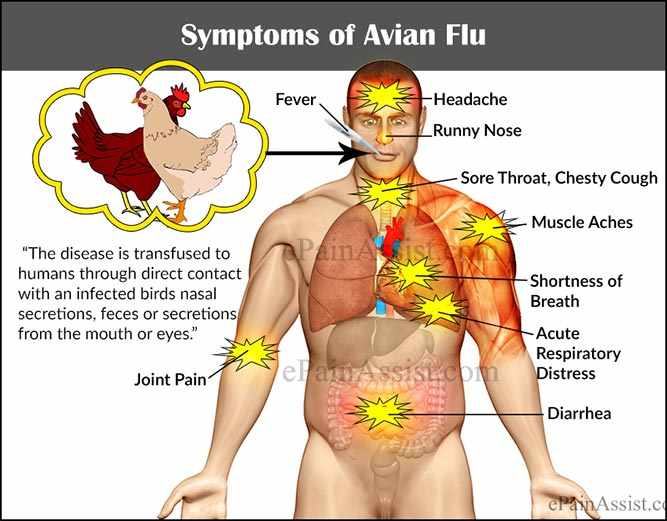 ما هي اعراض انفلونزا الطيور ؟