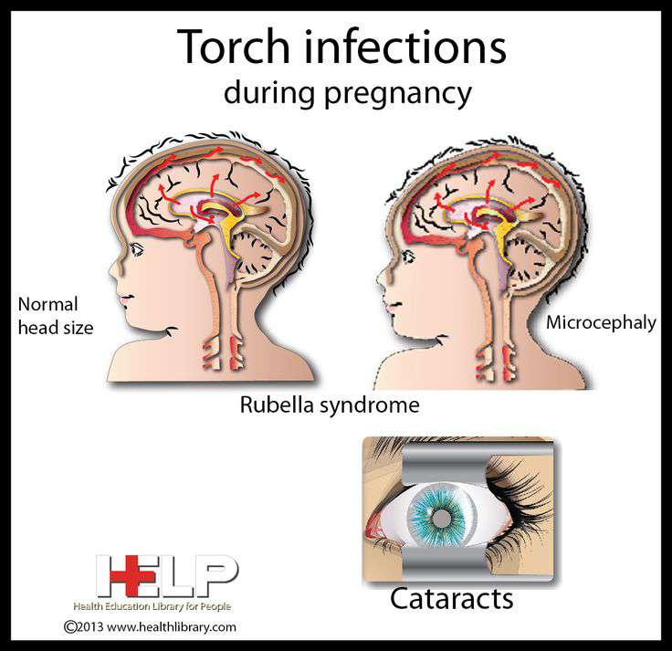 ماذا تعني كلمة torch