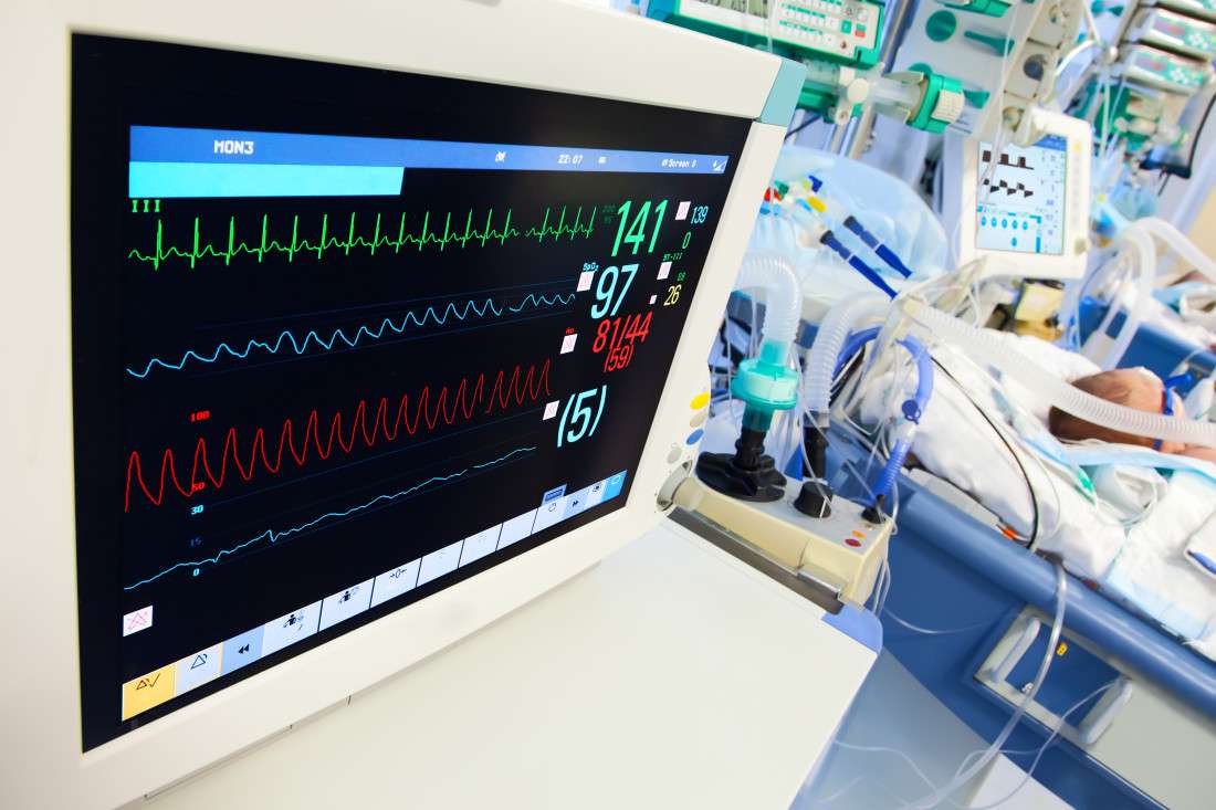 مراقبة الطفل و الرضيع في وحدة العناية المركزة