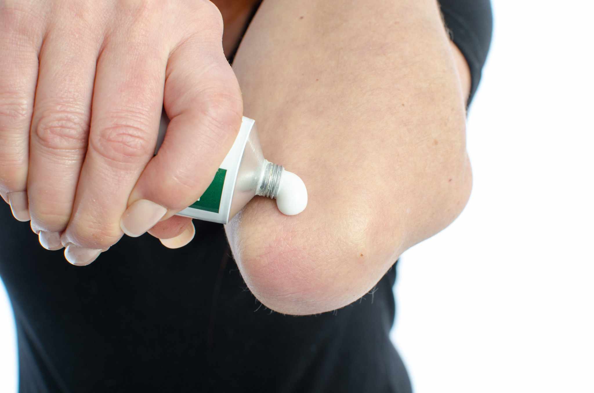 مرهم الكورتيزون الكورتيكو ستيروئيدات الموضعية"Topical Corticosteroids"