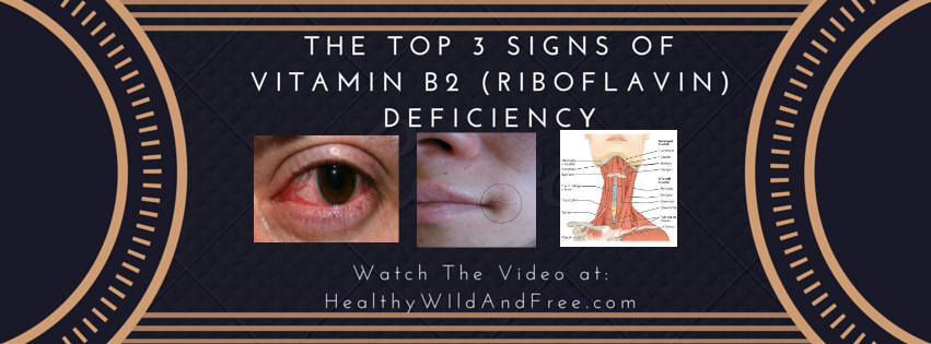 نقص الفيتامين ب2 أو عوز الريبوفلافين