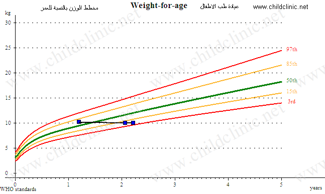 نقص النمو عند الأطفال