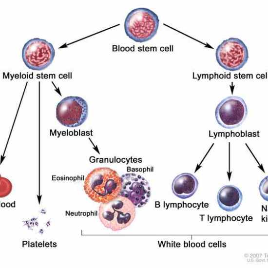 سرطان الدم الليمفاوي الحاد عند الأطفال