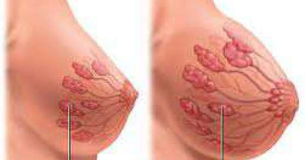 تبدلات الثدي خلال الحمل