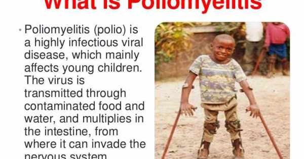 مرض شلل الاطفال