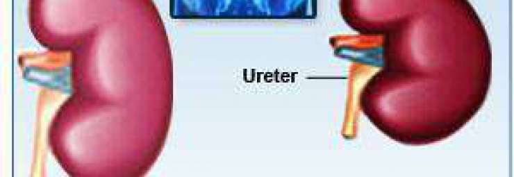 ما هو الفشل الكلوي عند الأطفال وأعراضه Elmarada