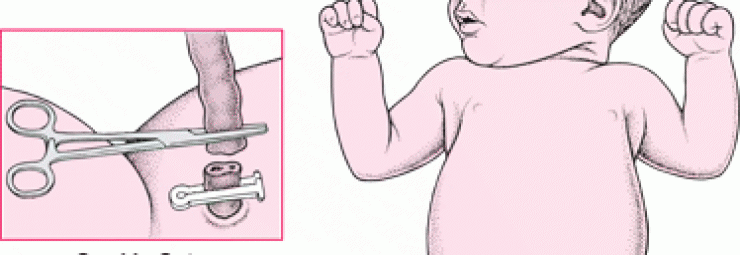 الولادة الطبيعية