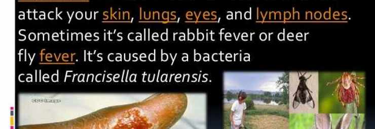 التولاريميا أو حمى الارانب