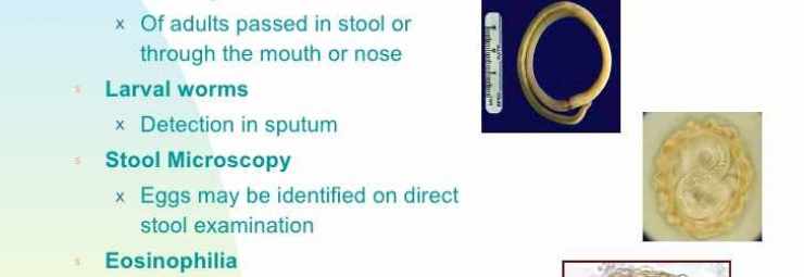 تشخيص ديدان الاسكارس