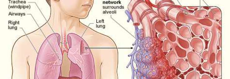 خلل تروية الرئتين عند الأطفال