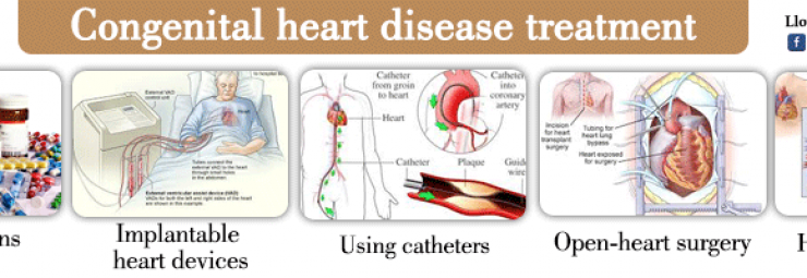 علاج تشوهات القلب عند الأطفال و الرضع