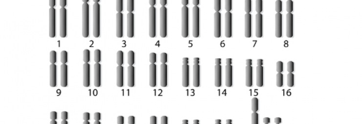 متلازمة XYY