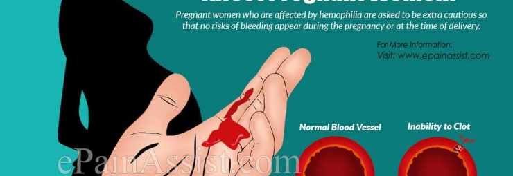 مرض الناعور الهيموفيليا و الحمل والولادة