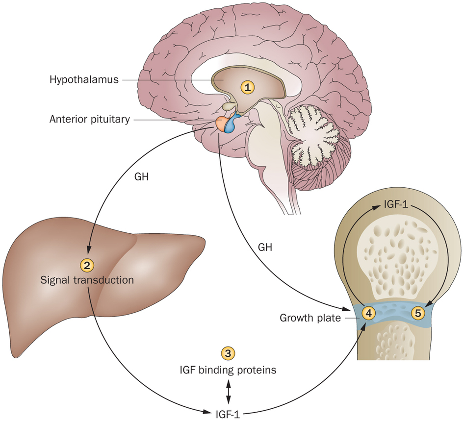 Hypopituitarism