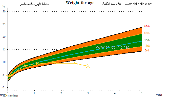 مخطط النمو : الوزن الناقص للطفل 